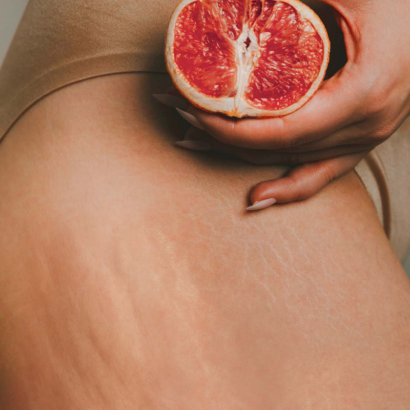 Recette d'huile de soin anti-cellulite