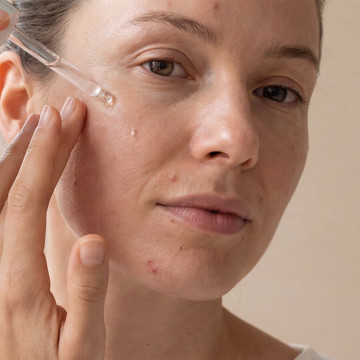 Recette de soin local anti-boutons aux huiles essentielles